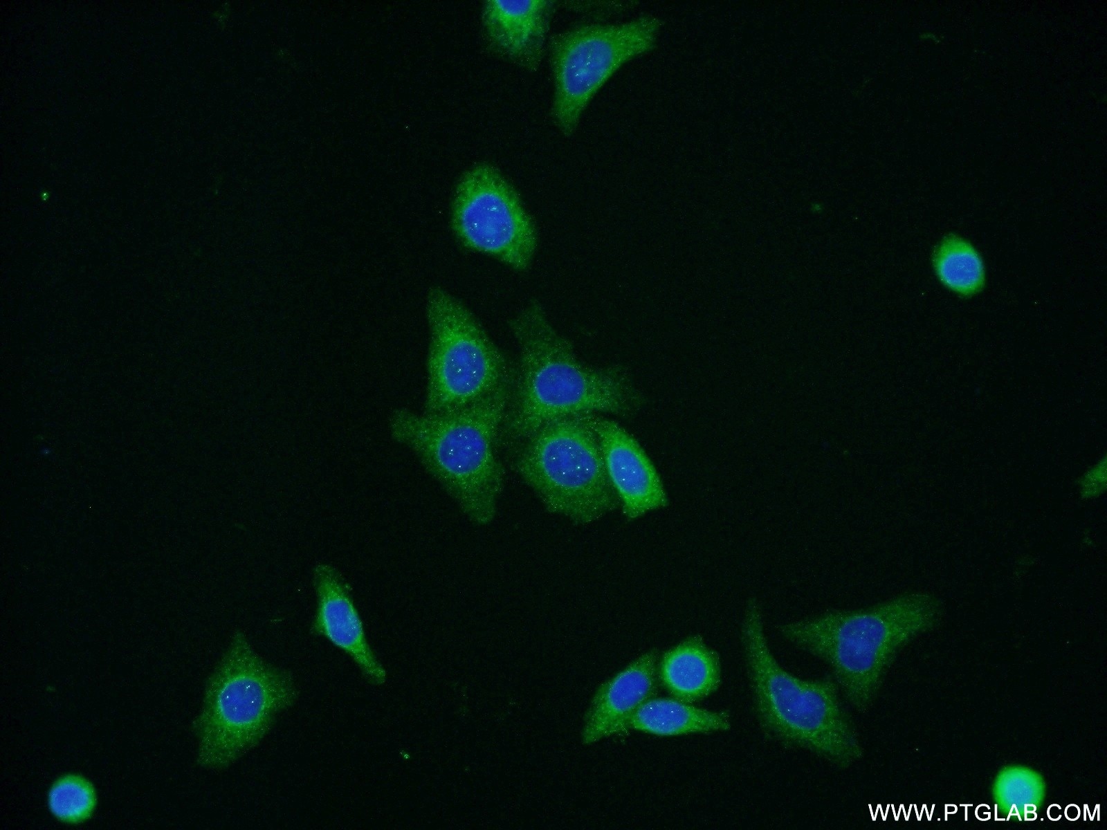 Immunofluorescence (IF) / fluorescent staining of HepG2 cells using ERGIC1 Polyclonal antibody (16108-1-AP)