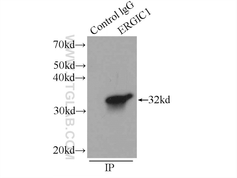 Immunoprecipitation (IP) experiment of HepG2 cells using ERGIC1 Polyclonal antibody (16108-1-AP)