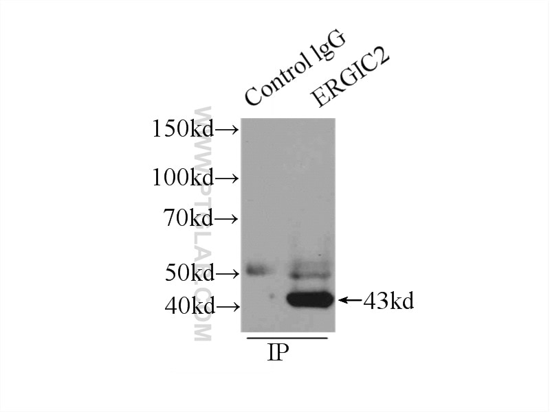 Immunoprecipitation (IP) experiment of HepG2 cells using ERGIC2 Polyclonal antibody (11927-1-AP)