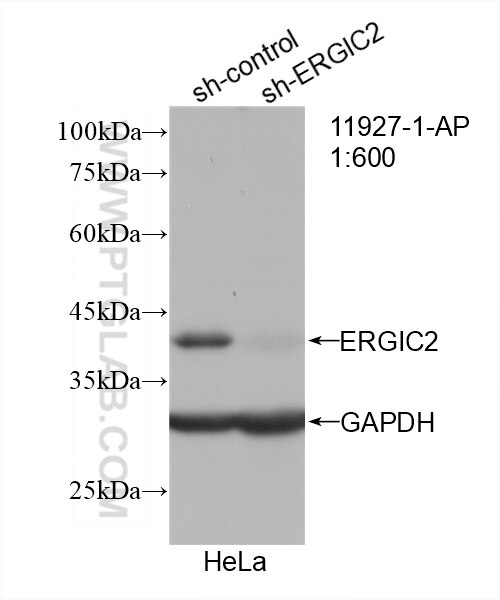 Western Blot (WB) analysis of HeLa cells using ERGIC2 Polyclonal antibody (11927-1-AP)