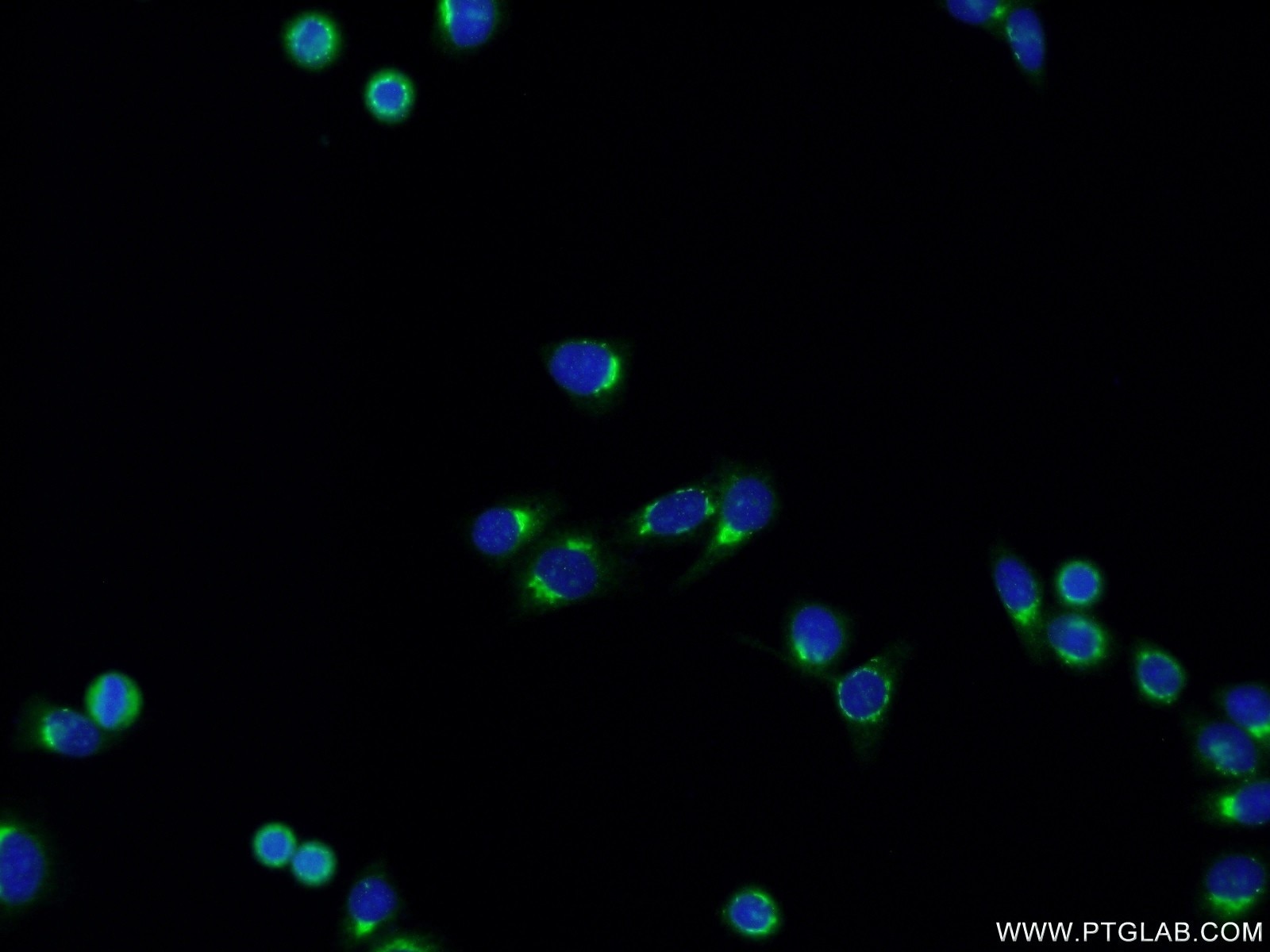 Immunofluorescence (IF) / fluorescent staining of HepG2 cells using ERGIC3 Polyclonal antibody (16029-1-AP)