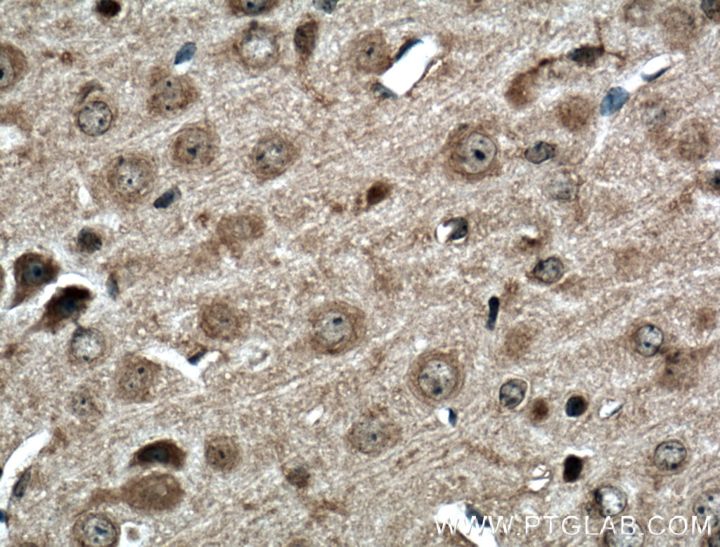 Immunohistochemistry (IHC) staining of mouse brain tissue using ERGIC3 Polyclonal antibody (16029-1-AP)
