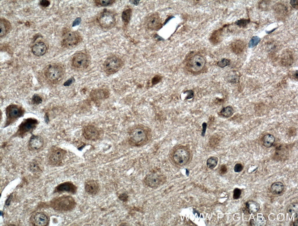 IHC staining of mouse brain using 16029-1-AP