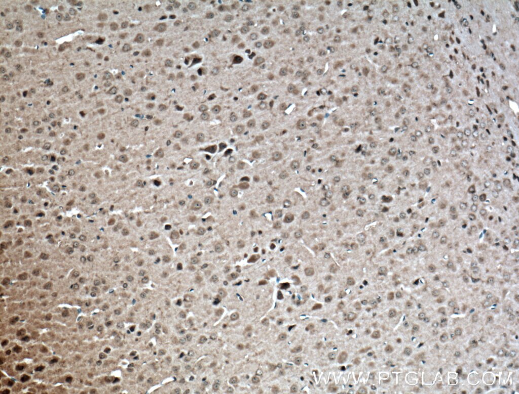 IHC staining of mouse brain using 16029-1-AP