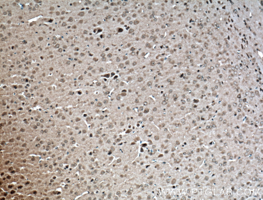 Immunohistochemistry (IHC) staining of mouse brain tissue using ERGIC3 Polyclonal antibody (16029-1-AP)