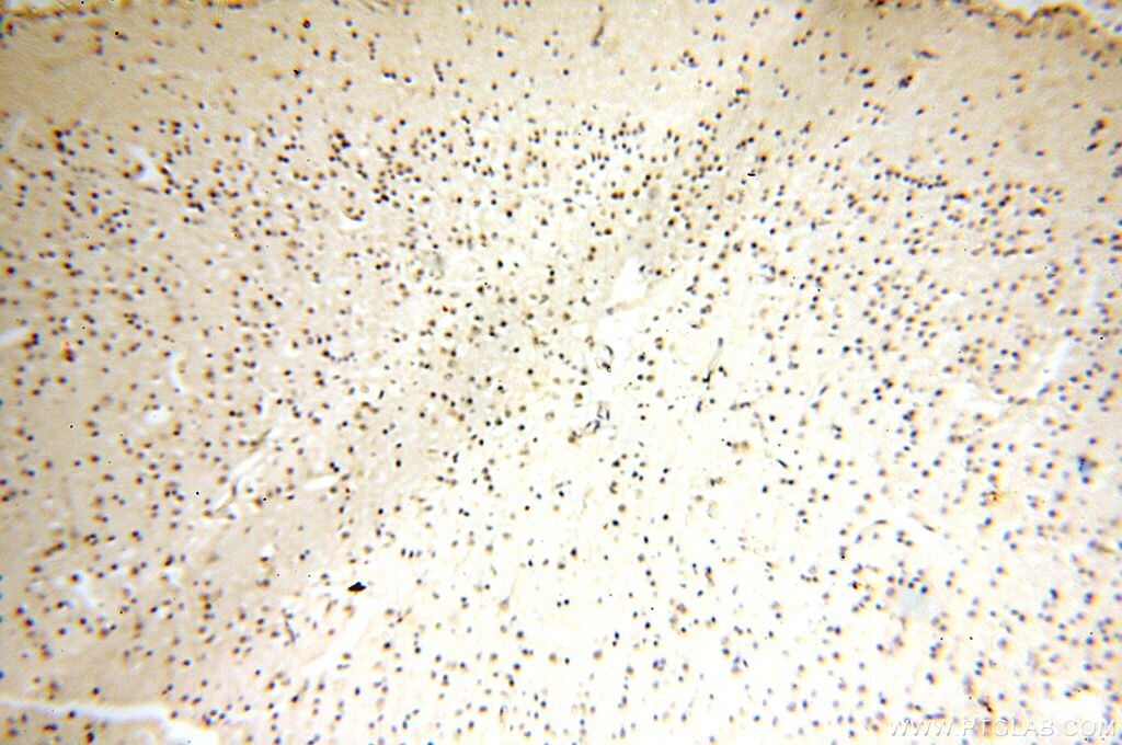 Immunohistochemistry (IHC) staining of human brain tissue using ERH Polyclonal antibody (15974-1-AP)