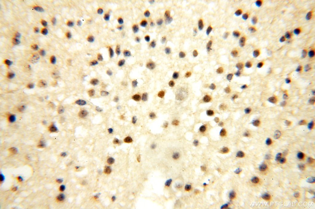 Immunohistochemistry (IHC) staining of human brain tissue using ERH Polyclonal antibody (15974-1-AP)