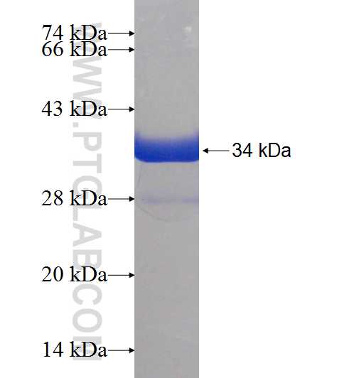 ERH fusion protein Ag8761 SDS-PAGE