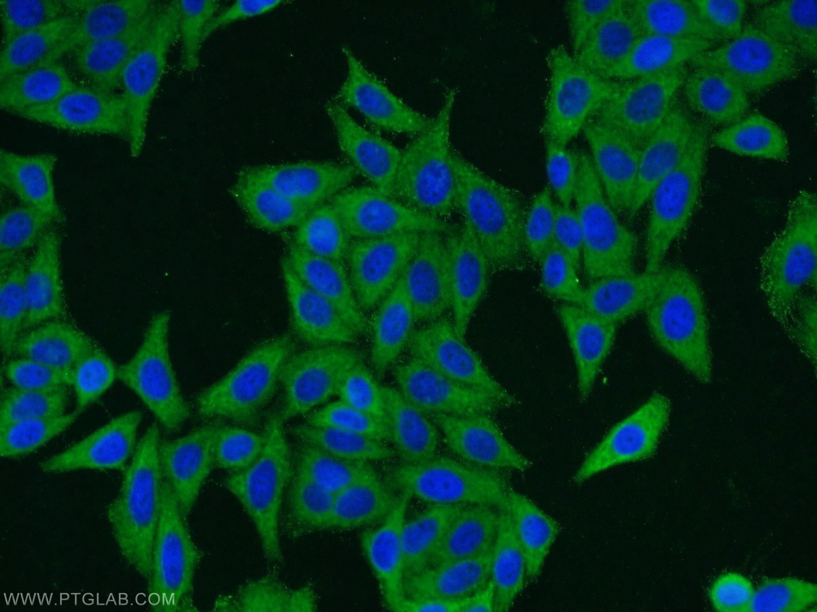 Immunofluorescence (IF) / fluorescent staining of HepG2 cells using ERI1 Polyclonal antibody (14592-1-AP)