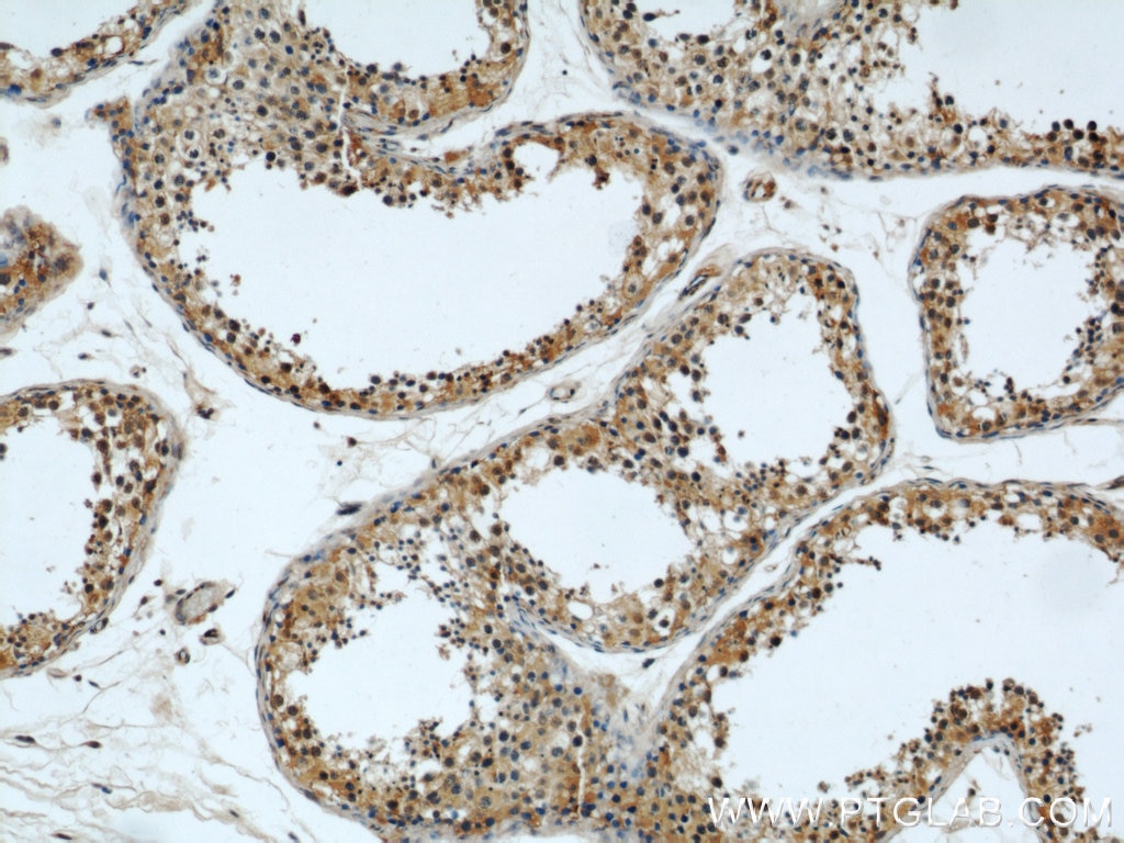 Immunohistochemistry (IHC) staining of human testis tissue using ERI1 Polyclonal antibody (14592-1-AP)