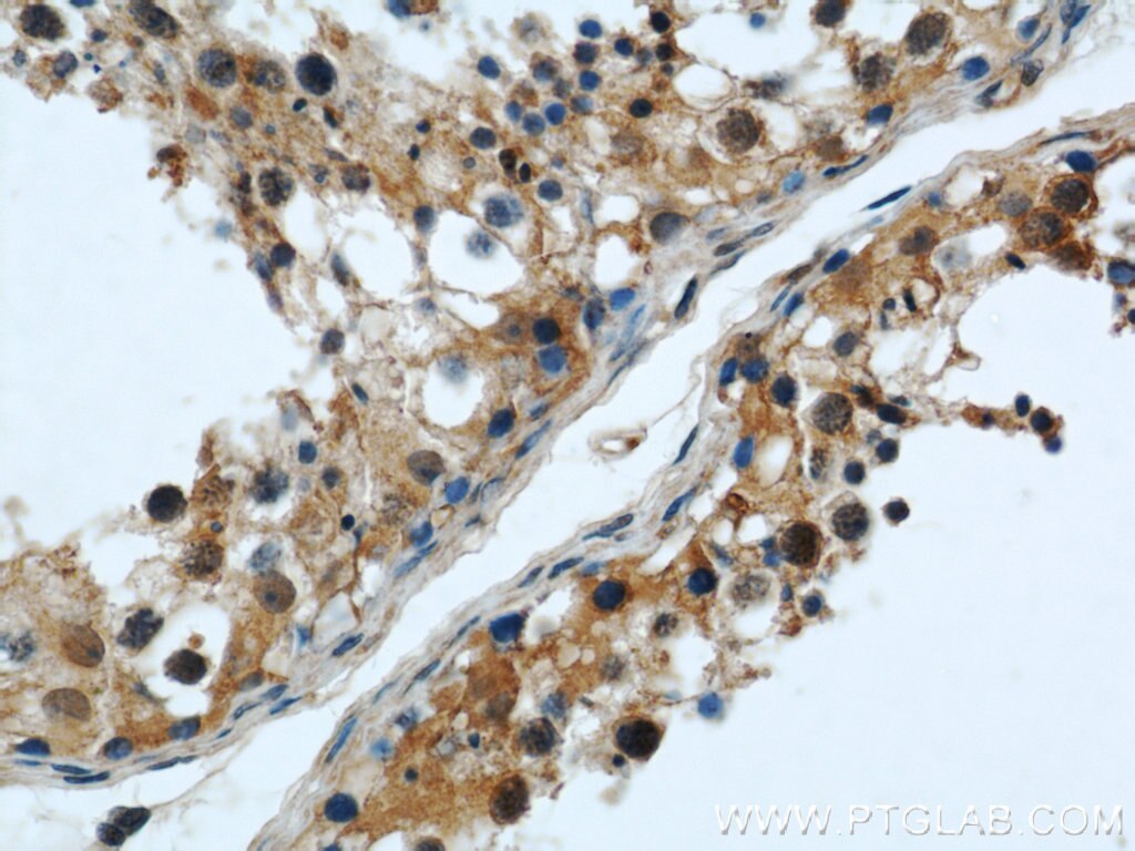 Immunohistochemistry (IHC) staining of human testis tissue using ERI1 Polyclonal antibody (14592-1-AP)