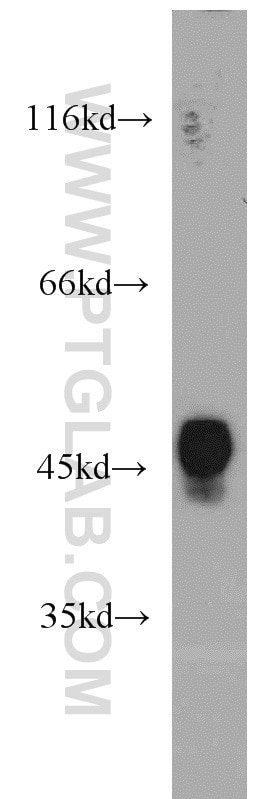 Western Blot (WB) analysis of HL-60 cells using ERI1 Polyclonal antibody (14592-1-AP)