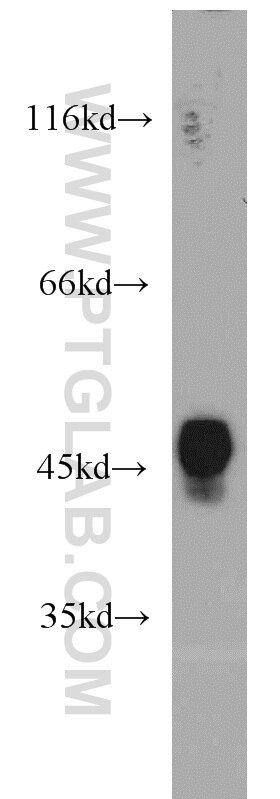 WB analysis of HL-60 using 14592-1-AP