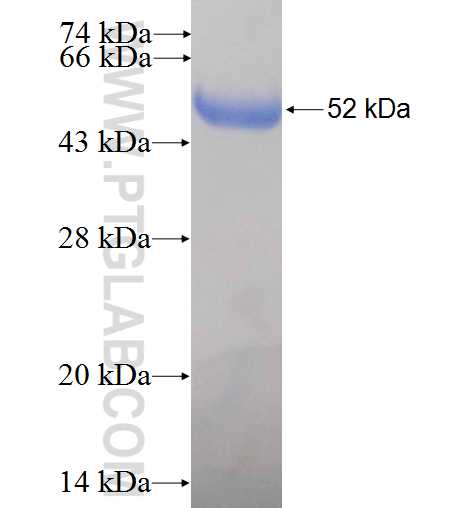 ERI1 fusion protein Ag6125 SDS-PAGE