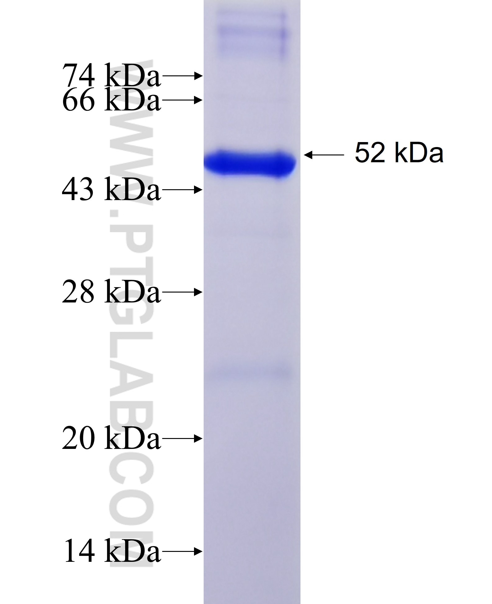 ERI1 fusion protein Ag6125 SDS-PAGE