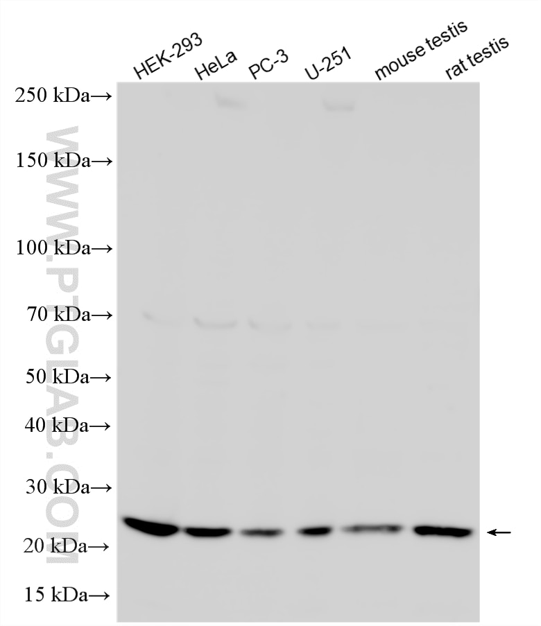 Western Blot (WB) analysis of various lysates using ERI3 Polyclonal antibody (10548-1-AP)