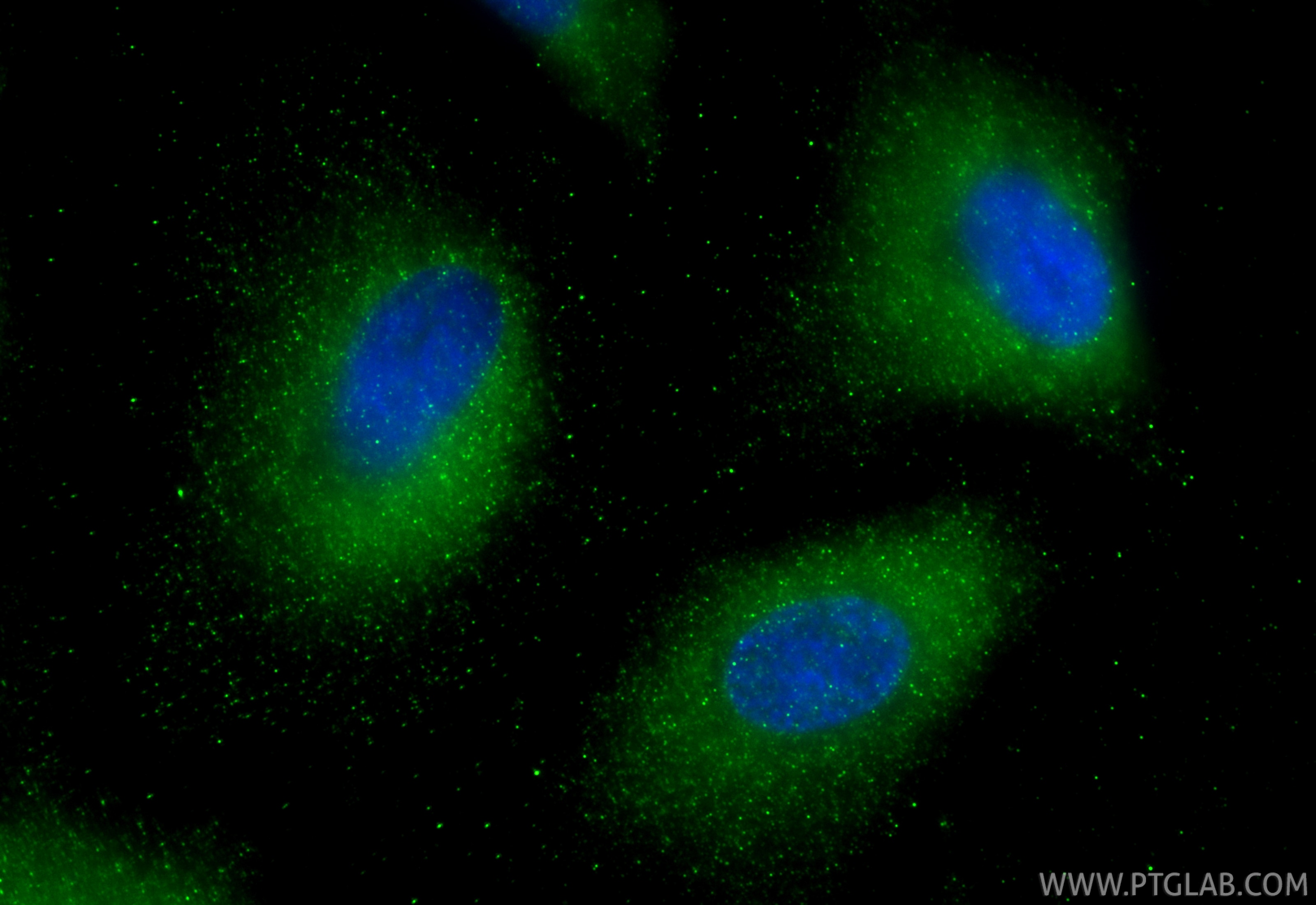 Immunofluorescence (IF) / fluorescent staining of A549 cells using ERK1/2 Monoclonal antibody (60929-1-Ig)