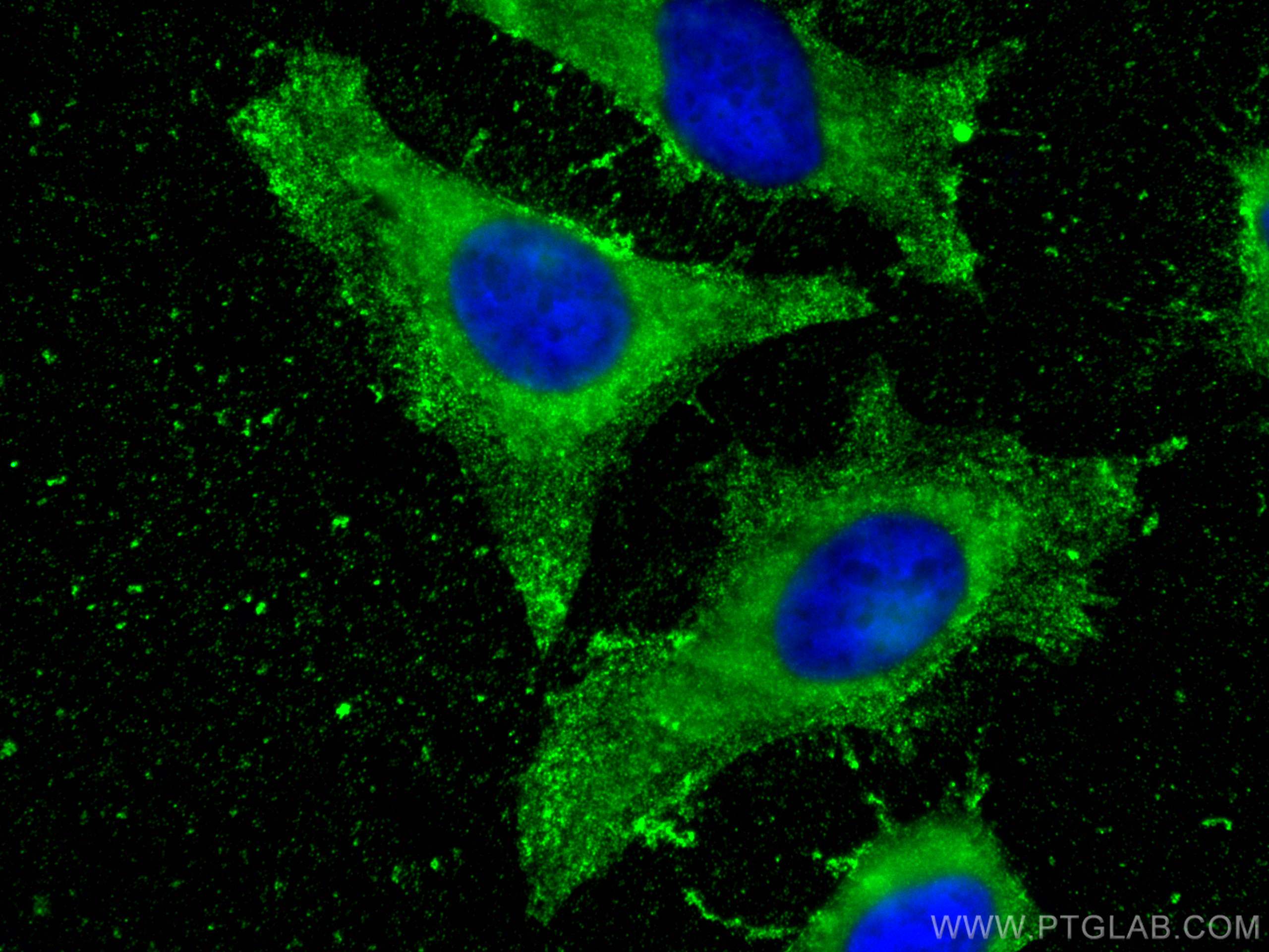 Immunofluorescence (IF) / fluorescent staining of HeLa cells using ERK1/2 Monoclonal antibody (66192-1-Ig)