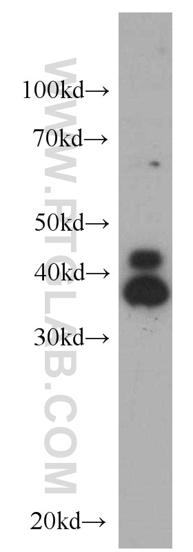 Western Blot (WB) analysis of HepG2 cells using ERK1/2 Monoclonal antibody (66192-1-Ig)