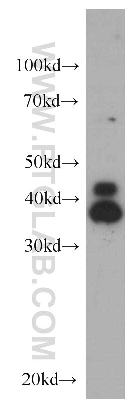 WB analysis of HepG2 using 66192-1-Ig