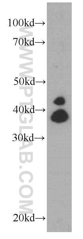 Western Blot (WB) analysis of MCF-7 cells using ERK1/2 Monoclonal antibody (66192-1-Ig)