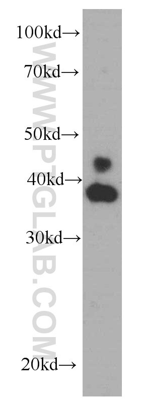 Western Blot (WB) analysis of HeLa cells using ERK1/2 Monoclonal antibody (66192-1-Ig)