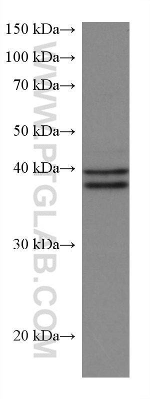 Western Blot (WB) analysis of ROS1728 cells using ERK1/2 Monoclonal antibody (67170-1-Ig)