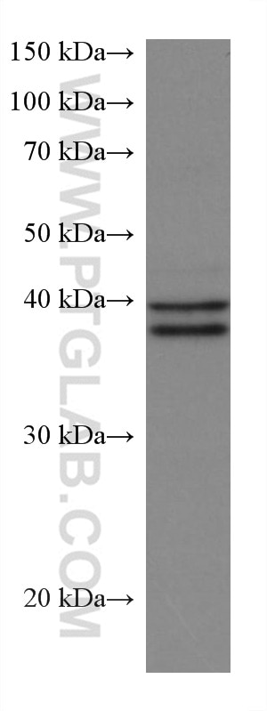 WB analysis of ROS1728 using 67170-1-Ig