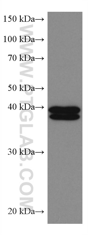 Western Blot (WB) analysis of Jurkat cells using ERK1/2 Monoclonal antibody (67170-1-Ig)