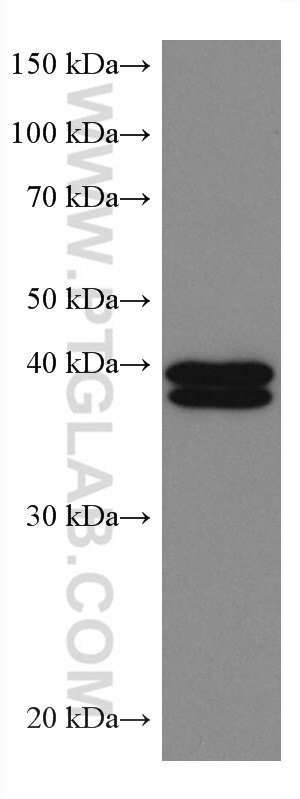 WB analysis of Jurkat using 67170-1-Ig