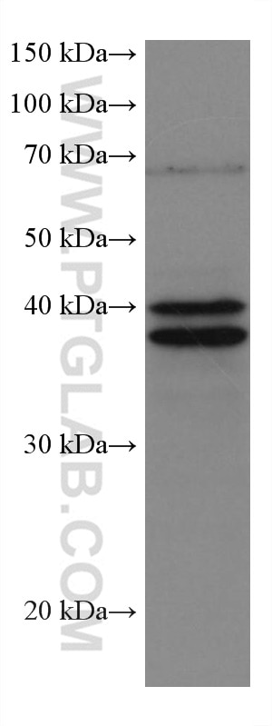Western Blot (WB) analysis of RAW 264.7 cells using ERK1/2 Monoclonal antibody (67170-1-Ig)
