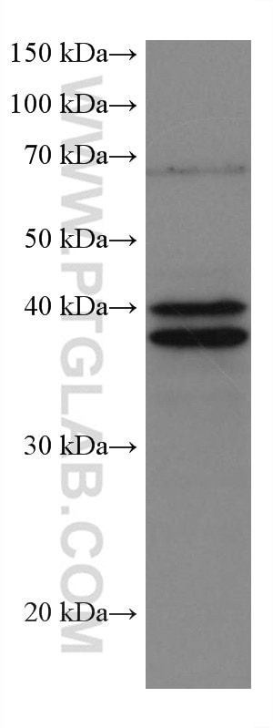 WB analysis of RAW 264.7 using 67170-1-Ig