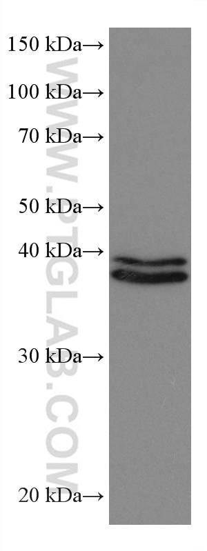 Western Blot (WB) analysis of HeLa cells using ERK1/2 Monoclonal antibody (67170-1-Ig)