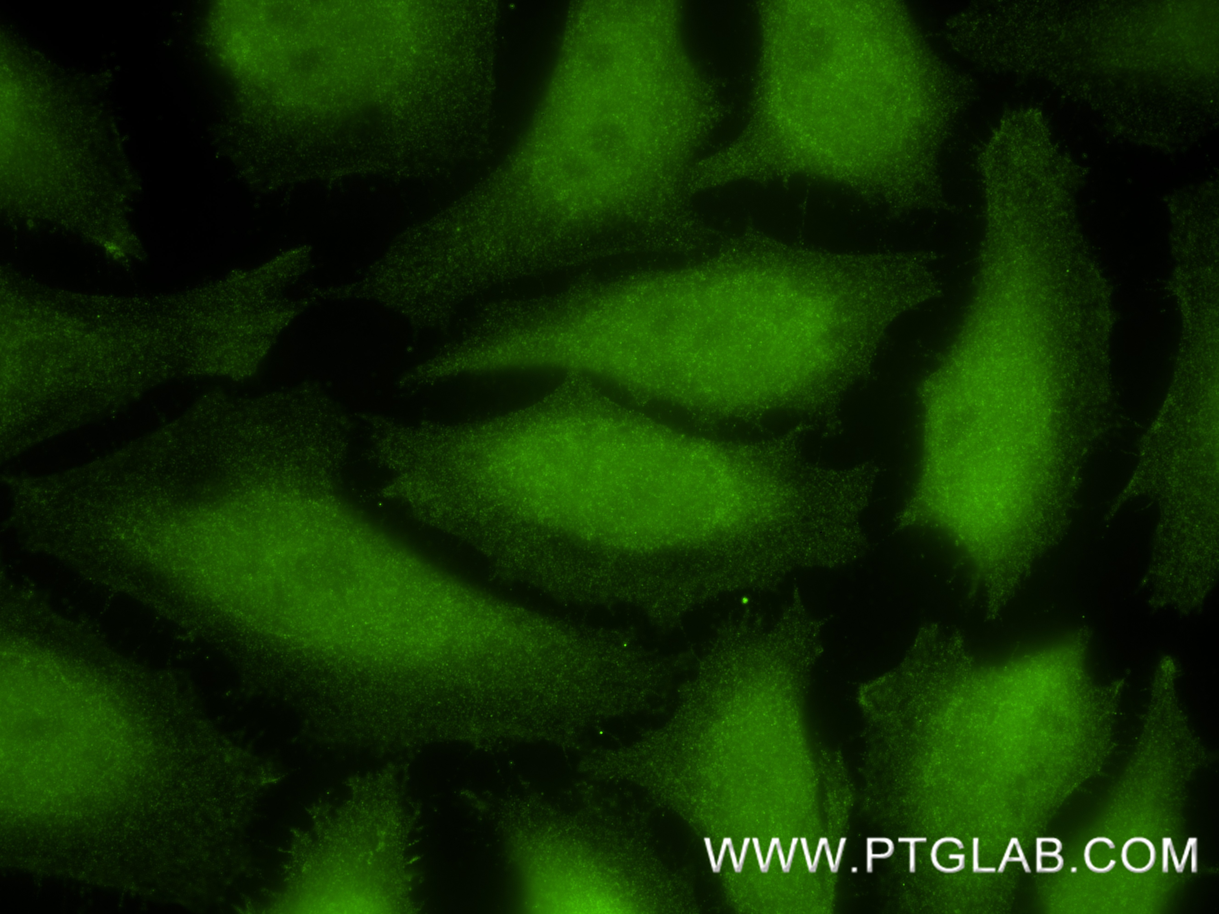 IF Staining of HeLa using 83533-1-RR (same clone as 83533-1-PBS) Immunofluorescence (IF) / fluorescent staining of HeLa cells using ERK1/2 Recombinant monoclonal antibody (83533-1-RR)
