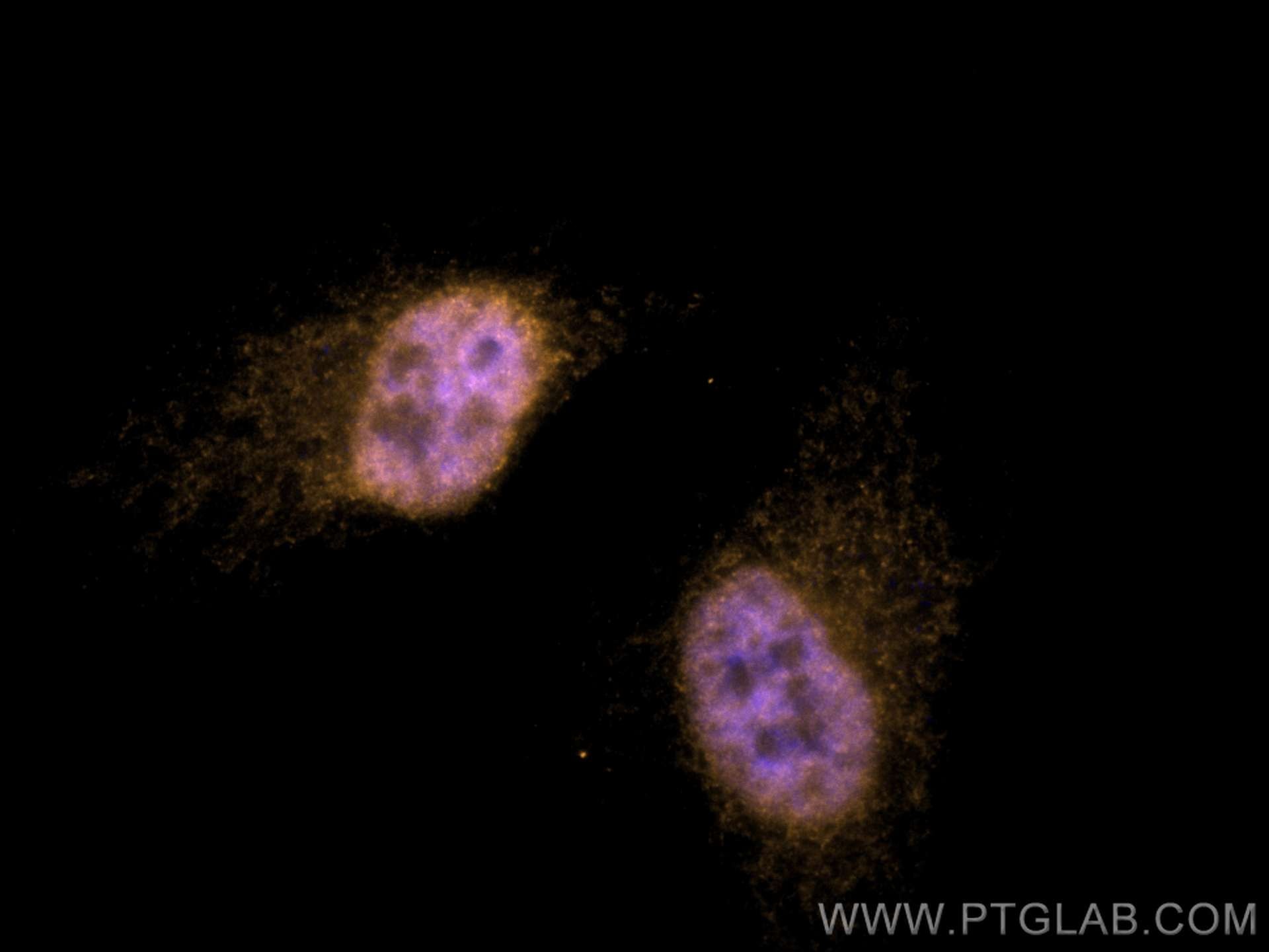Immunofluorescence (IF) / fluorescent staining of HeLa cells using CoraLite®555-conjugated ERK1/2 Polyclonal antibody (CL555-51068)
