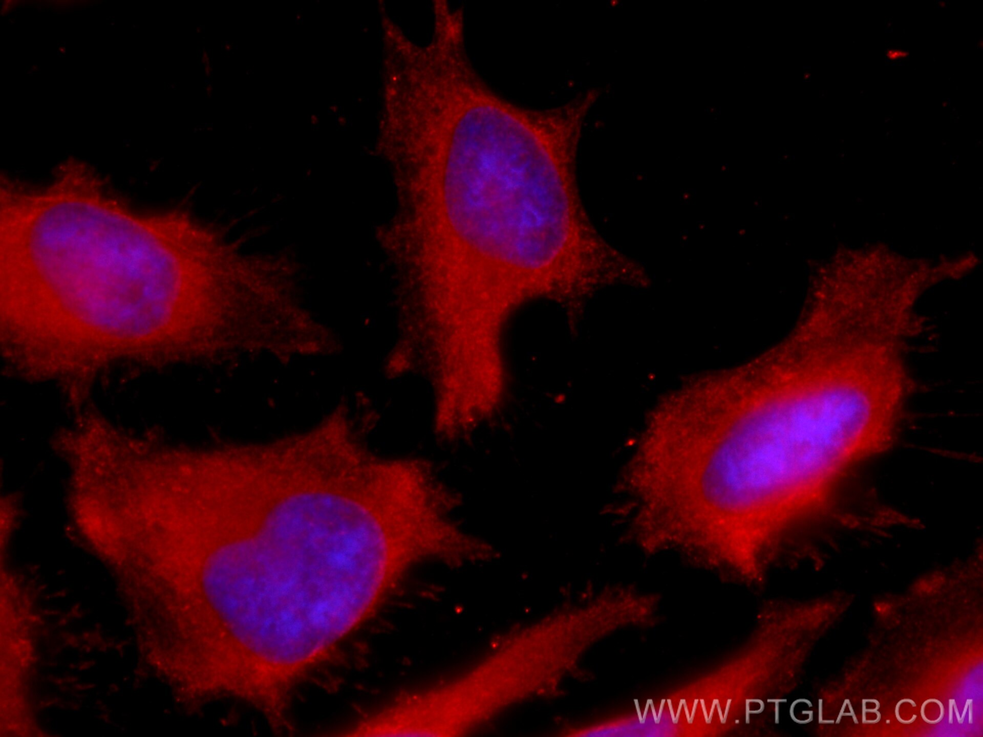 Immunofluorescence (IF) / fluorescent staining of HeLa cells using CoraLite®594-conjugated ERK1/2 Monoclonal antibody (CL594-66192)