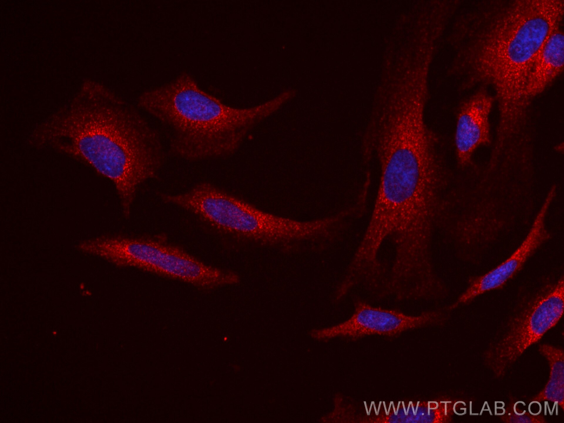 Immunofluorescence (IF) / fluorescent staining of HeLa cells using CoraLite®594-conjugated ERK1/2 Monoclonal antibody (CL594-66192)