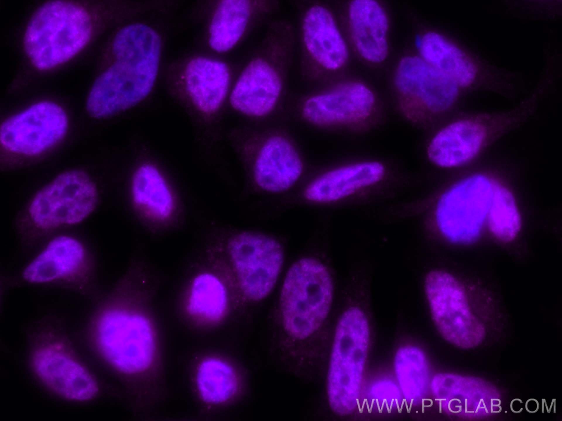 Immunofluorescence (IF) / fluorescent staining of HeLa cells using CoraLite® Plus 647-conjugated ERK1/2 Polyclonal an (CL647-51068)