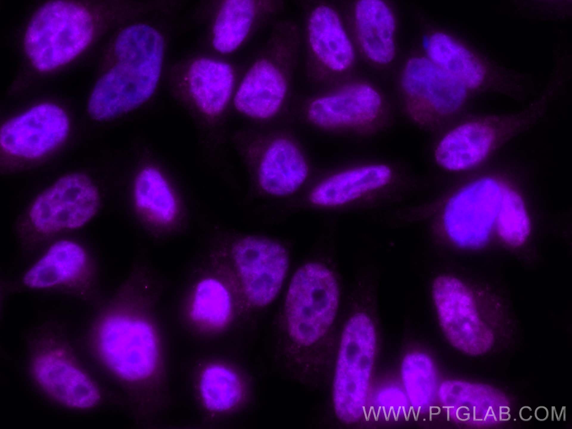 IF Staining of HeLa using CL647-51068