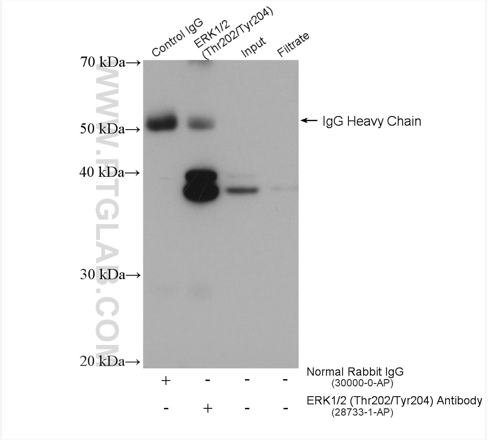 Immunoprecipitation (IP) experiment of PC-3 cells using Phospho-ERK1/2 (Thr202/Tyr204) Polyclonal antibody (28733-1-AP)