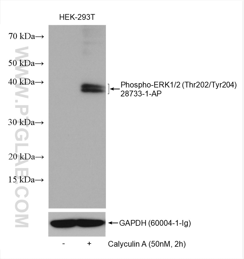 Western Blot (WB) analysis of various lysates using Phospho-ERK1/2 (Thr202/Tyr204) Polyclonal antibody (28733-1-AP)