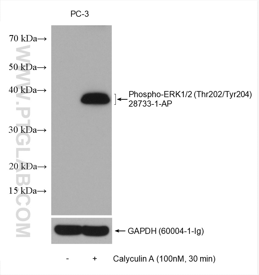 Phospho-ERK1/2 (Thr202/Tyr204)
