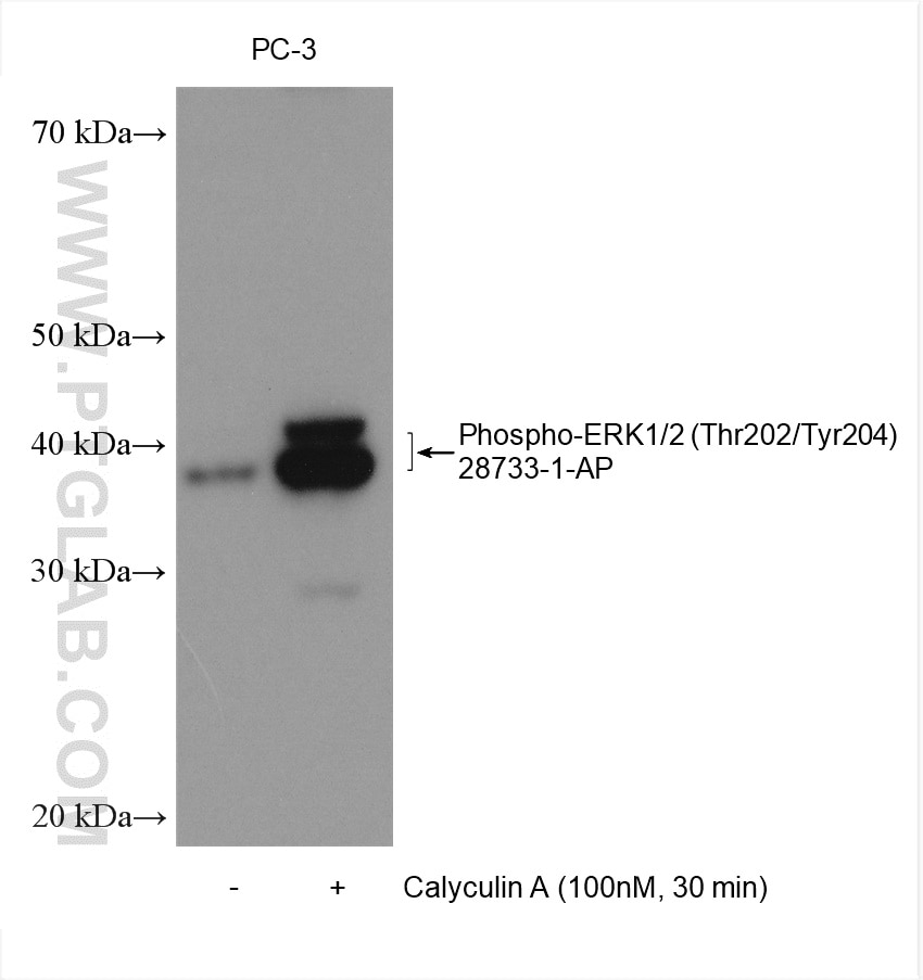 Western Blot (WB) analysis of various lysates using Phospho-ERK1/2 (Thr202/Tyr204) Polyclonal antibody (28733-1-AP)