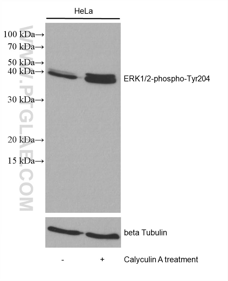 Western Blot (WB) analysis of HeLa cells using Phospho-ERK1/2 (Thr202/Tyr204) Recombinant antibod (80031-1-RR)