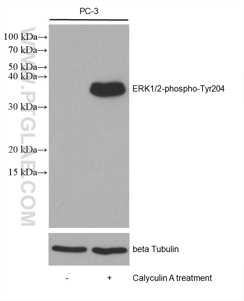 Phospho-ERK1/2 (Thr202/Tyr204)