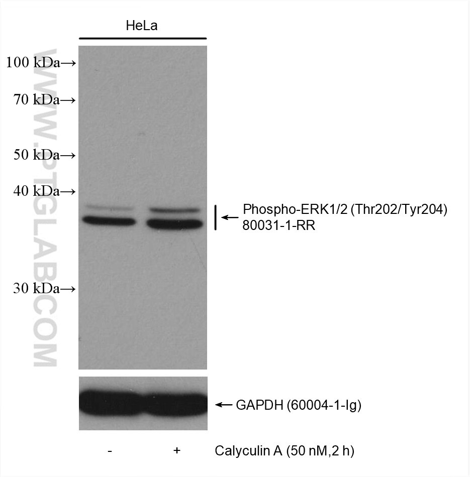 Western Blot (WB) analysis of various lysates using Phospho-ERK1/2 (Thr202/Tyr204) Recombinant antibod (80031-1-RR)