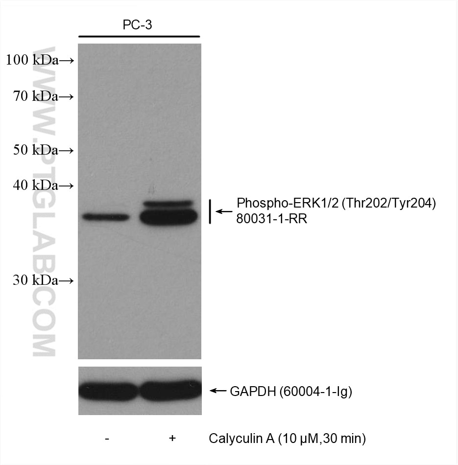 Western Blot (WB) analysis of various lysates using Phospho-ERK1/2 (Thr202/Tyr204) Recombinant antibod (80031-1-RR)