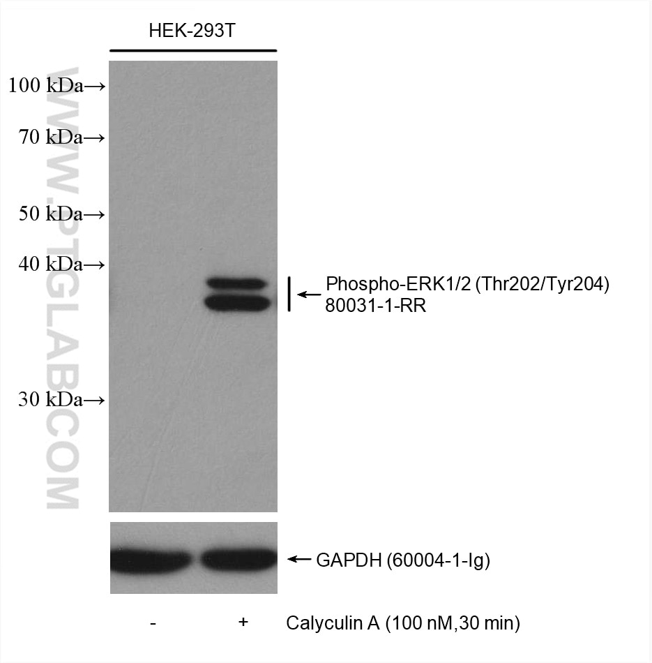 Western Blot (WB) analysis of various lysates using Phospho-ERK1/2 (Thr202/Tyr204) Recombinant antibod (80031-1-RR)