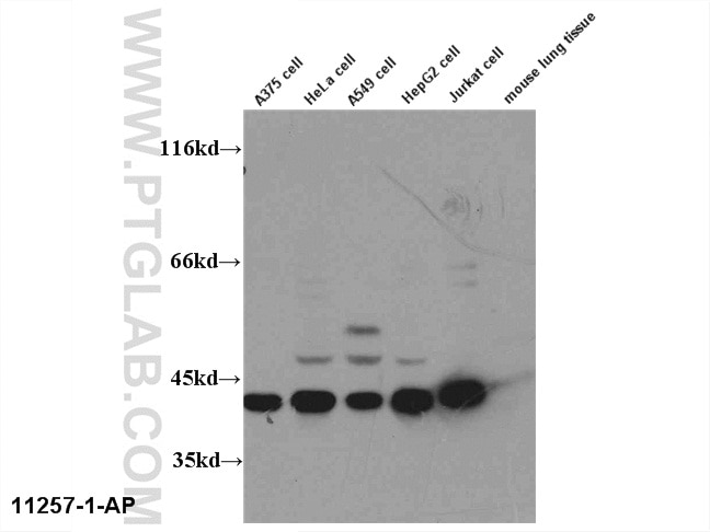 ERK1/2 Polyclonal antibody