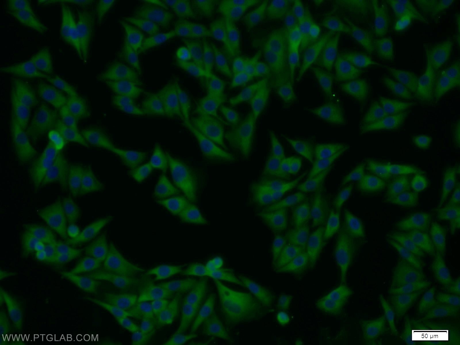 Immunofluorescence (IF) / fluorescent staining of A375 cells using ERK1/2 Polyclonal antibody (11257-1-AP)